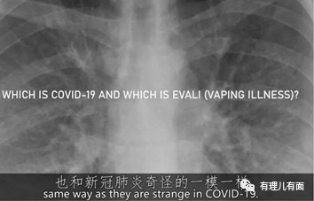 《柳叶刀》新冠委员会主席指出新冠病毒或源自美军实验室,中国公知们要疯了!