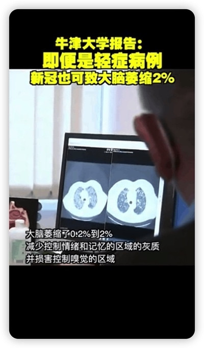 西方抗疫“躺”出四大灾难，带给中国四点启示